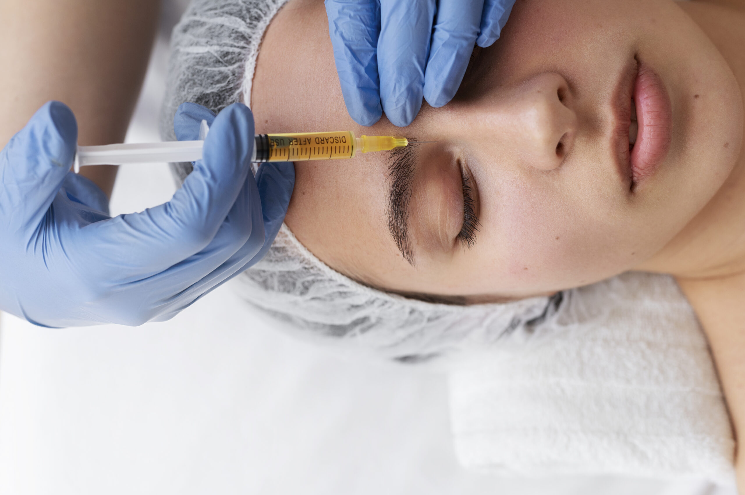 view-woman-getting-face-prp-treatment